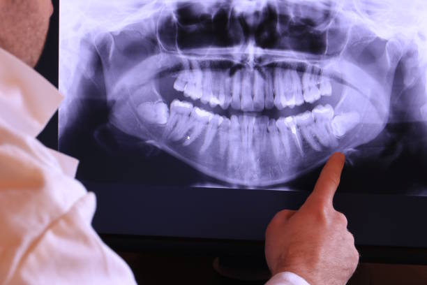 Best Emergency Care for Gum Disease in Salida, CA